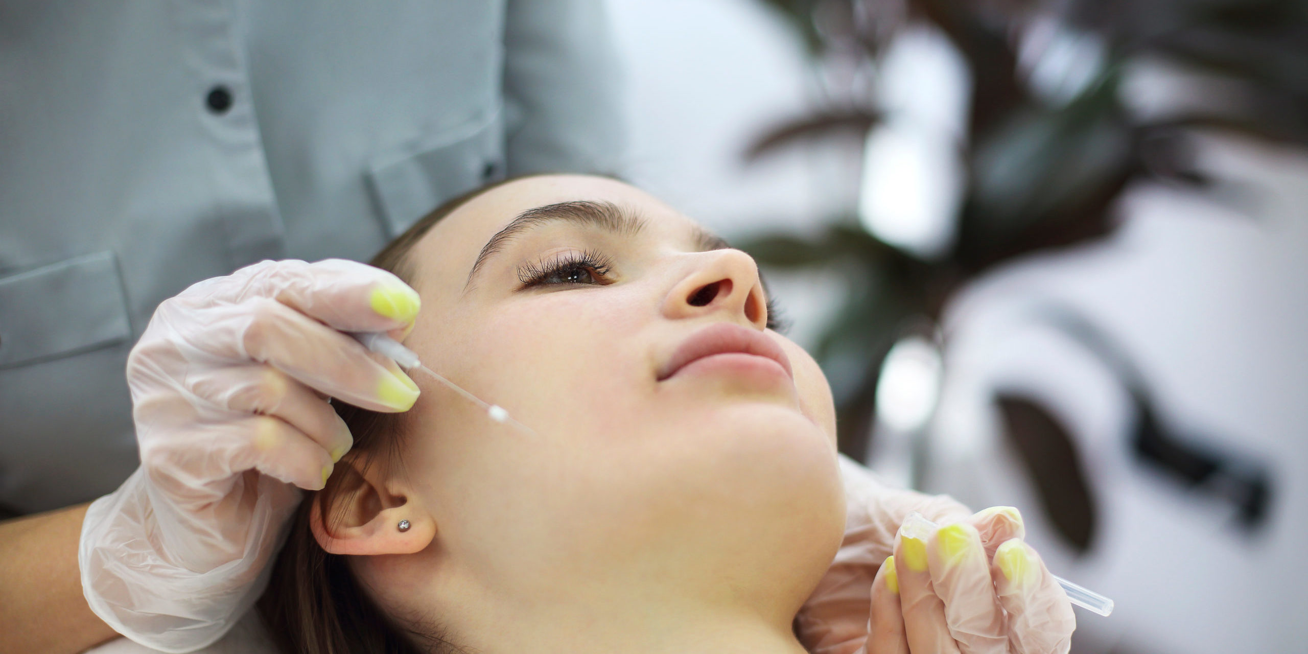 3D Meso Thread Face Lifting Treatment. Mesotherapy in Anti-aging Aesthetic Cosmetic Medicine